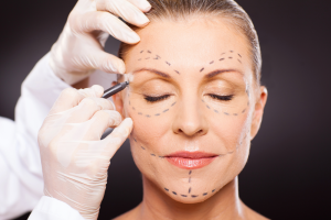 chirurgie-esthetique-visage